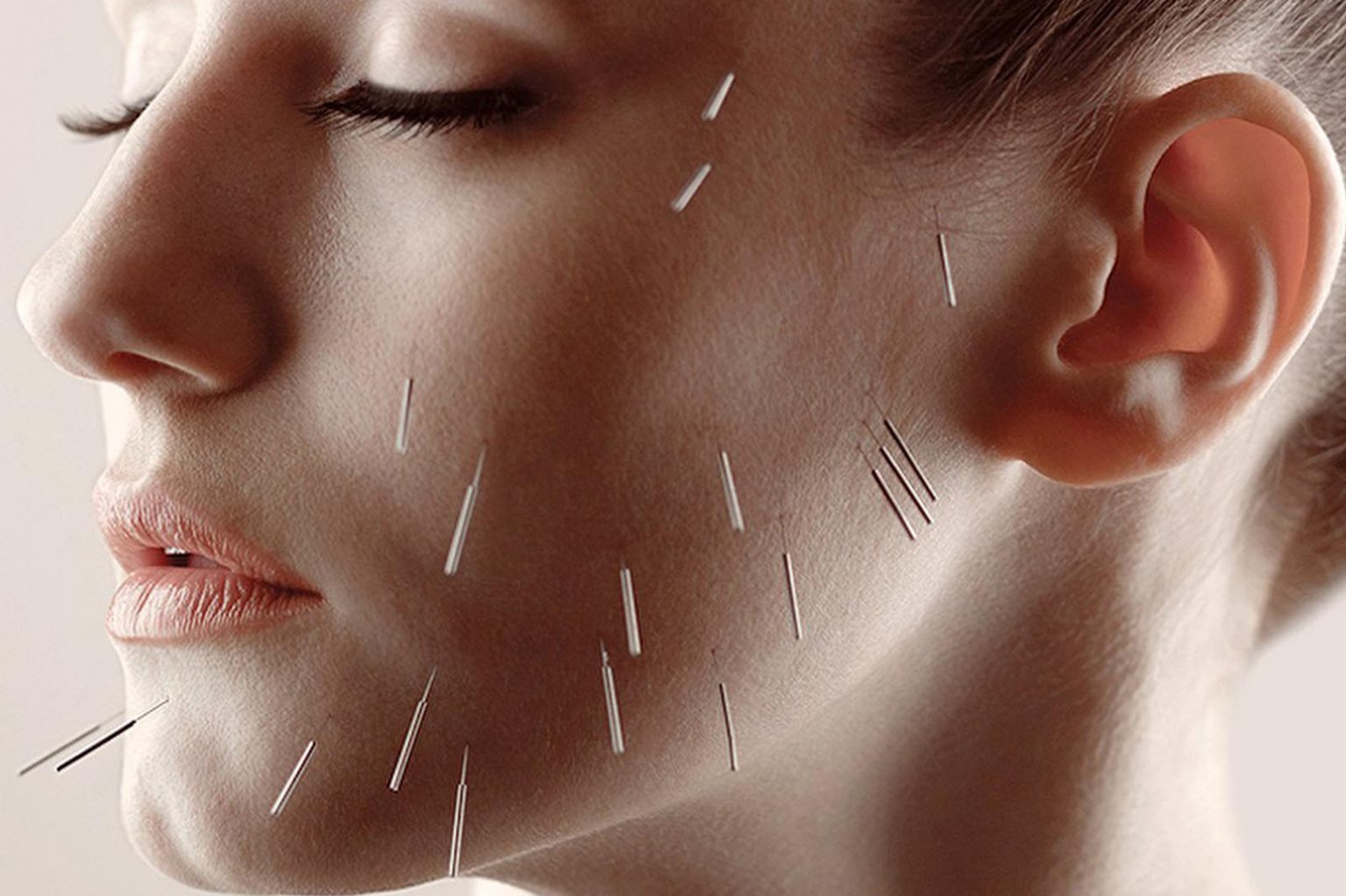 FACIAL ACUPUNCTURE New York Facial Body Rejuvenation