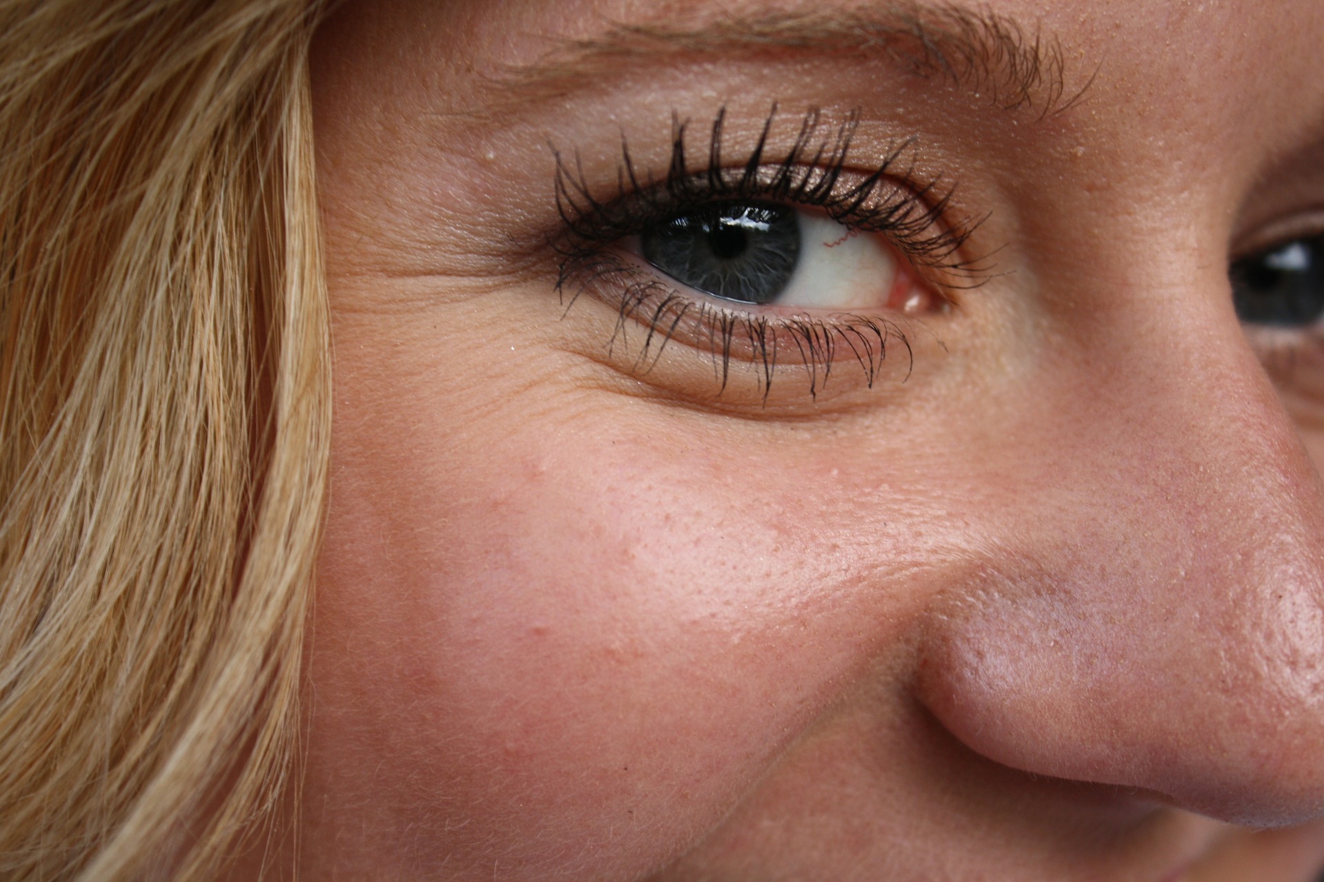 Wrinkle Treatments - New York Facial & Body Rejuvenation